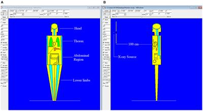 Impact of Eye and Breast Shielding on Organ Doses During Cervical Spine Radiography: Design and Validation of MIRD Computational Phantom
